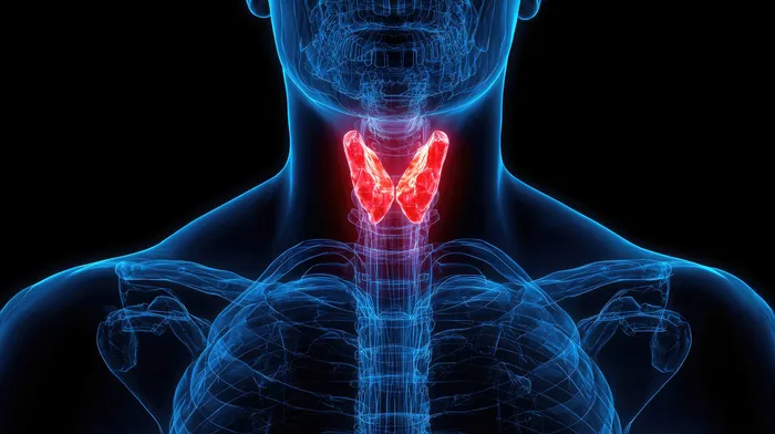 hypothyroidism