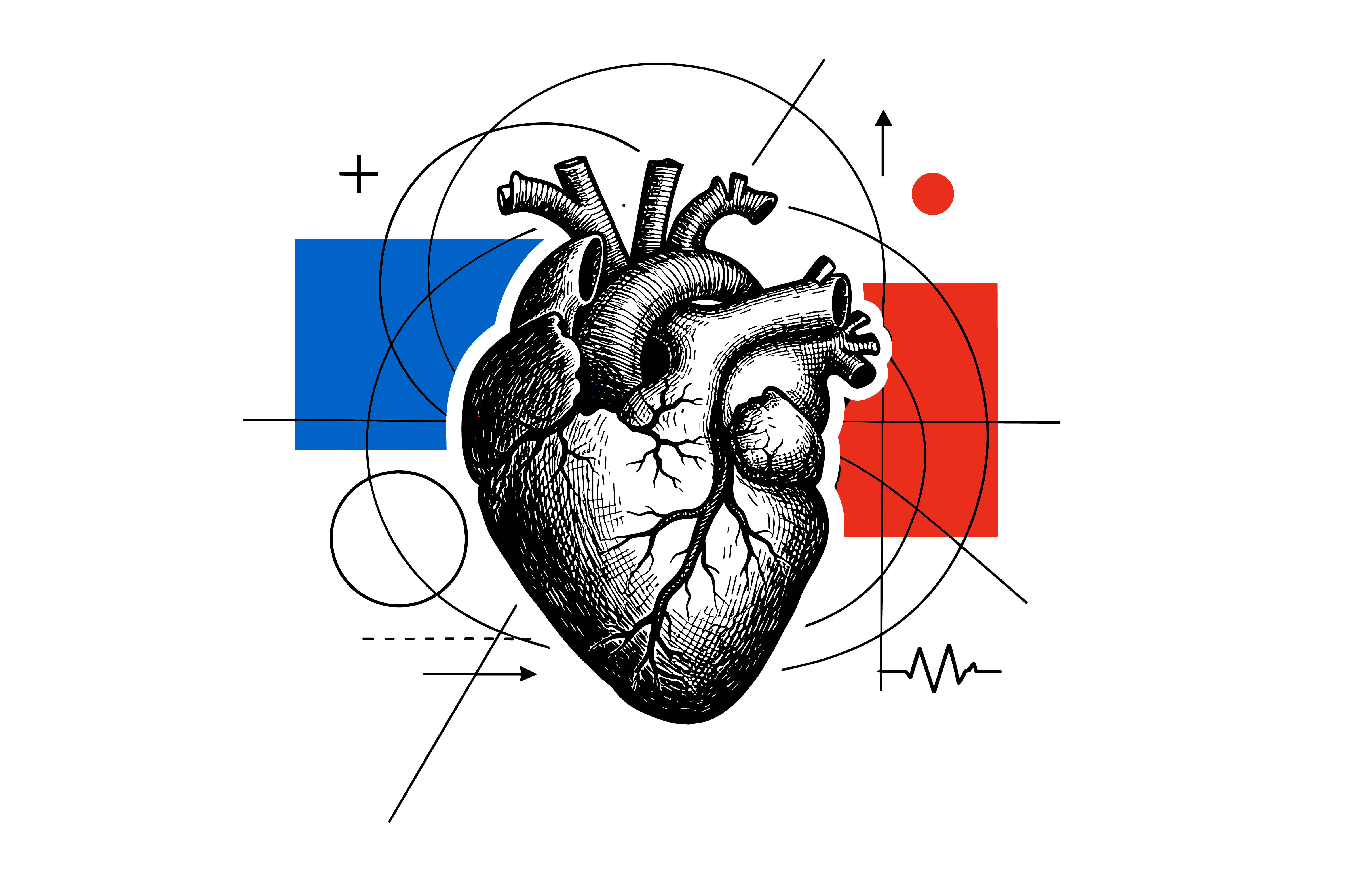 Complete Heart Block: Causes and Effects