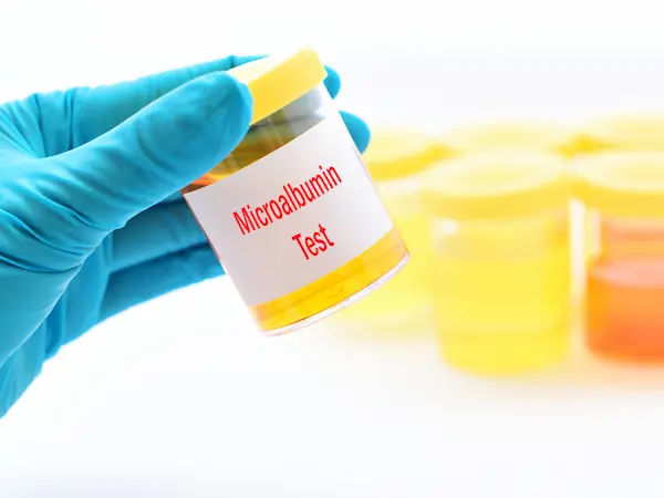 How To Reduce Urine Microalbumin?