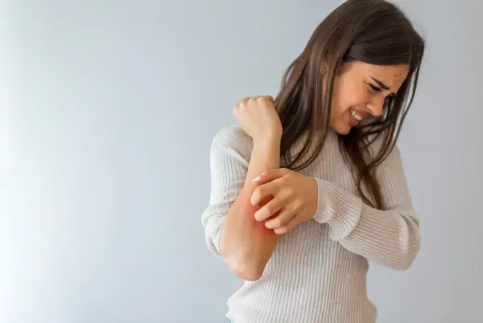 Plaque Psoriasis: Understanding, Managing, and Living with It