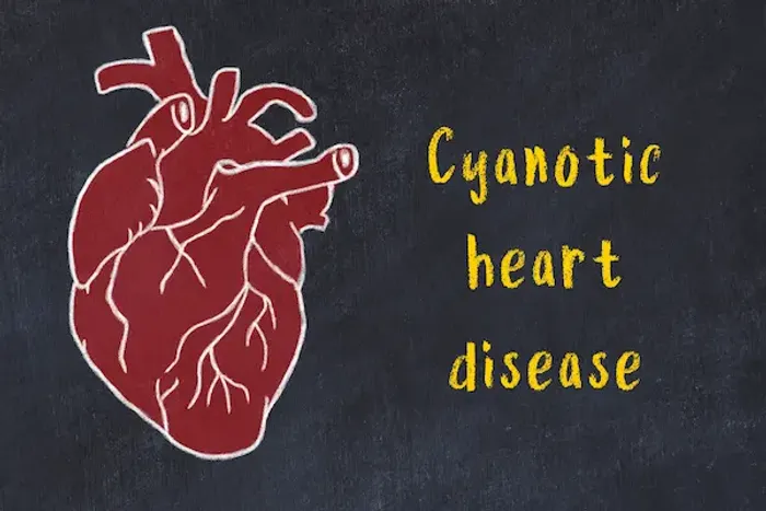 Cyanotic Congenital Heart Disease