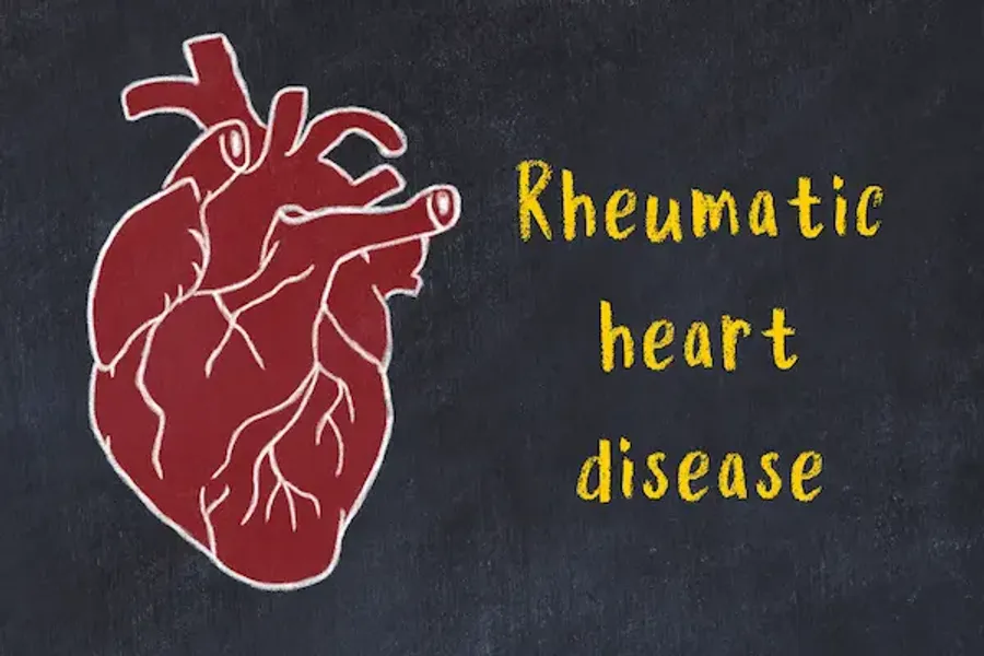 Rhd Exploring Clinical Features of Rheumatic Heart Disease