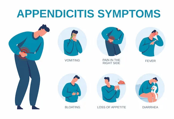 Appendicitis Signs