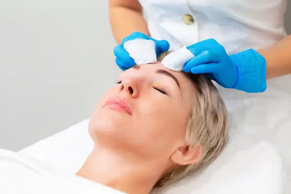 How to Get Rid of Forehead Acne?