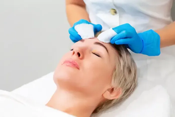 How to Get Rid of Forehead Acne?