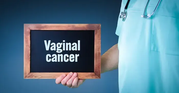 Vaginal Cancer: A Comprehensive Guide to Detection, Treatment and Prevention