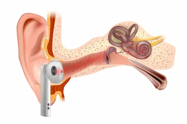 Hearing Aids Technology Advances