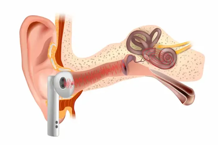 Hearing Aids Technology Advances