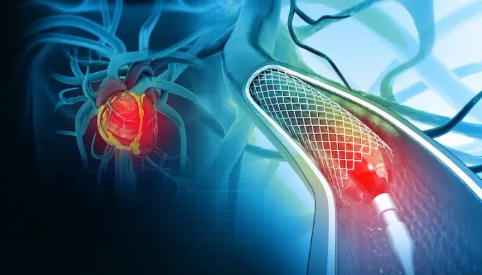 Before And After Angioplasty