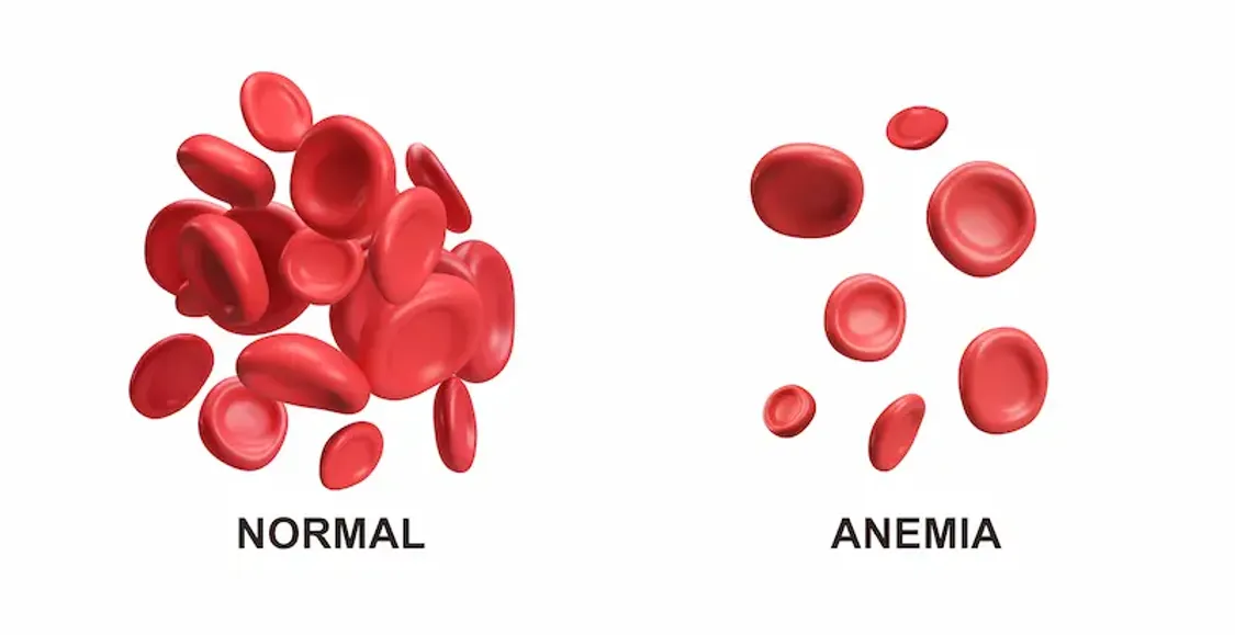 where should you inject a b12 shot How to Give a B12 Injection: Step-By-Step Instructions