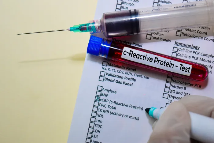 How to Reduce C Reactive Protein?