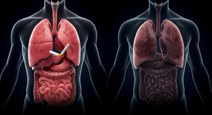 Non-Smokers and Lung Cancer