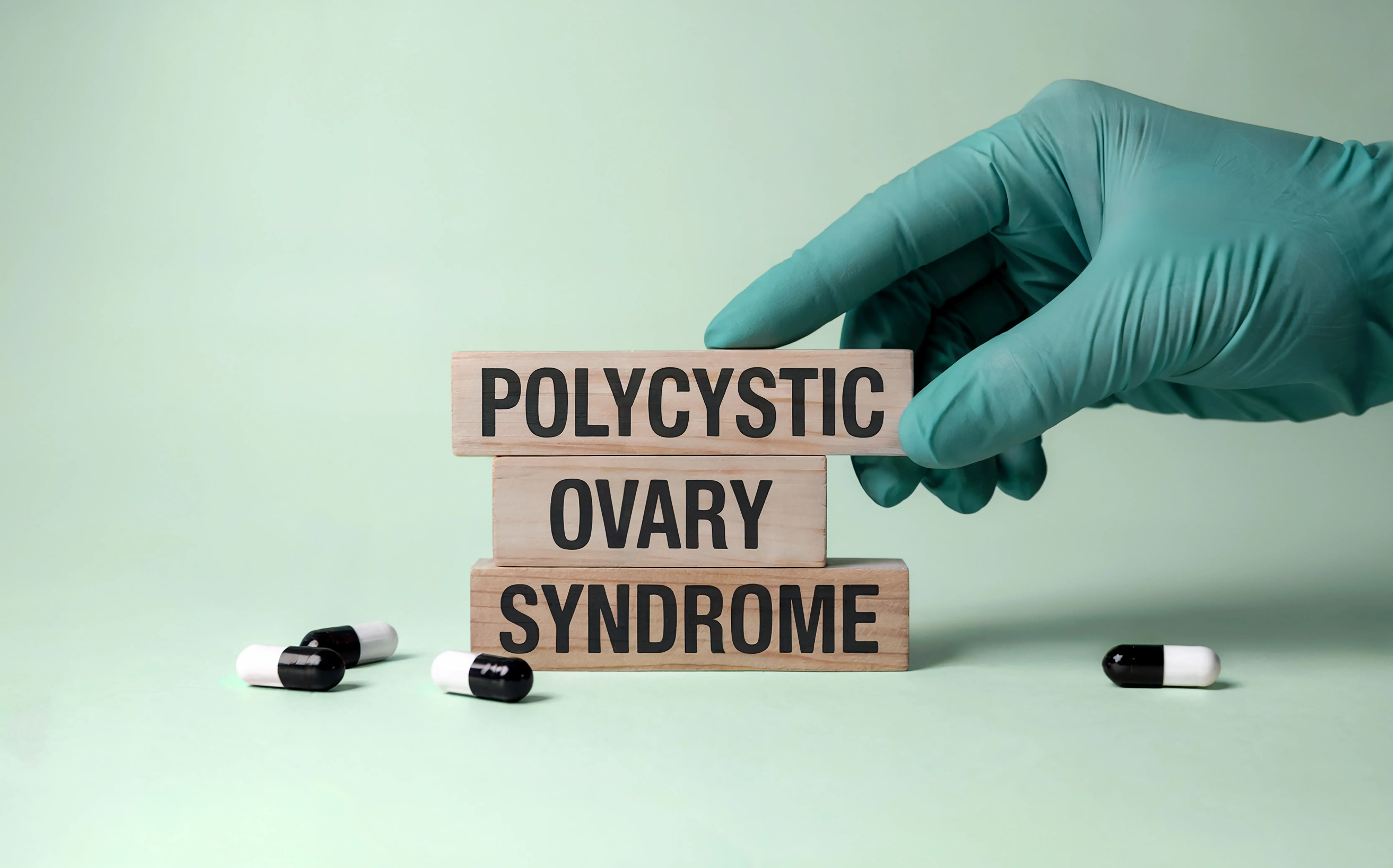 Polycystic Ovary Syndrome (PCOS): Causes, Symptoms and Treatment