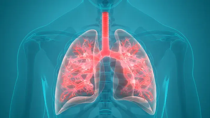 Pneumonia Causes and Treatment