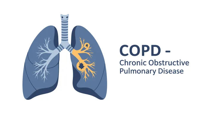Symptoms of Pulmonary Heart Disease