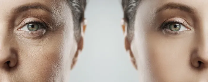 Skin Ageing: Expectations and Solutions