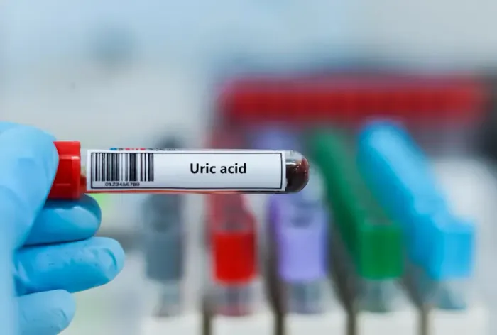 How to Reduce Uric Acid From Body: A Comprehensive Guide
