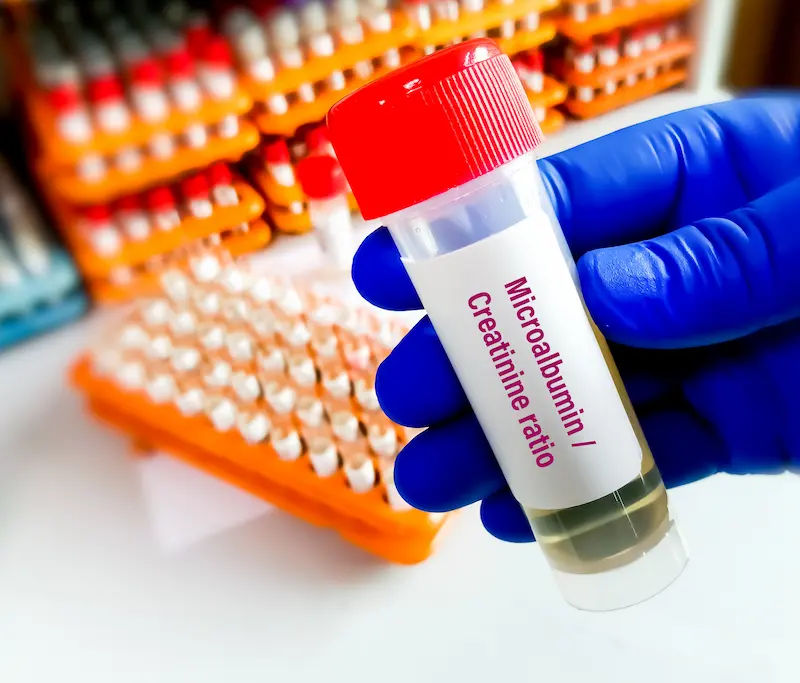 can you masturbate with a uti as a male Can You Get a UTI From Masturbating?