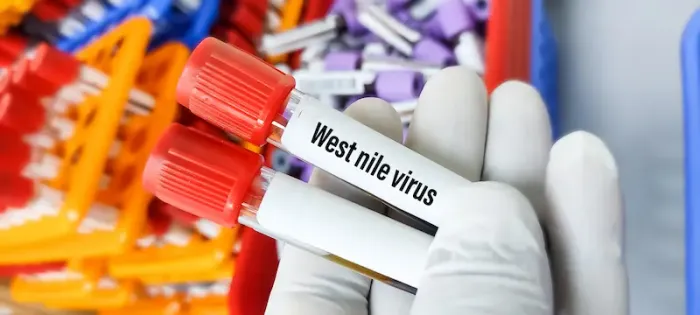 West Nile Virus: All You Need To Know