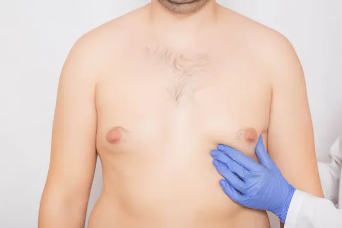 How to Reduce Man Boobs: A Comprehensive Guide