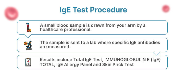 IgE-Test-Procedure