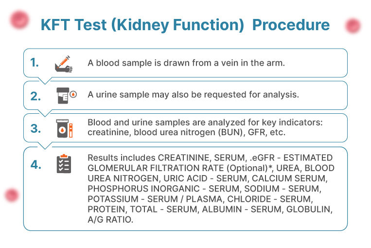 KFT Test Procedure