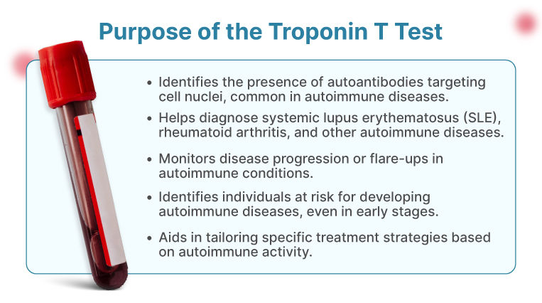 Purpose of the Troponin T Qualitative Test