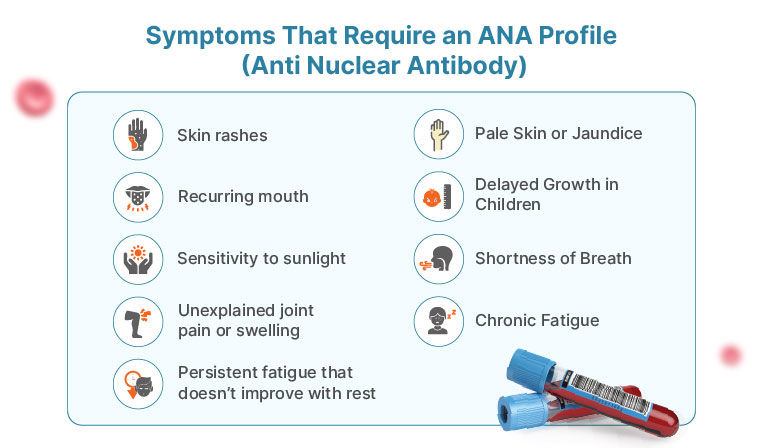 Symptoms ANA Test
