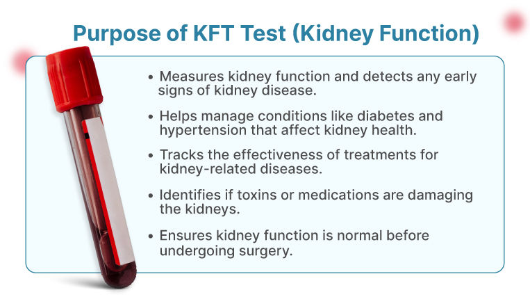 KFT Test Purpose