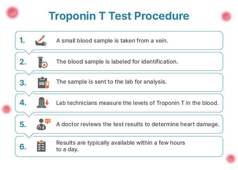 Procedure for Troponin T Qualitative Blood Test