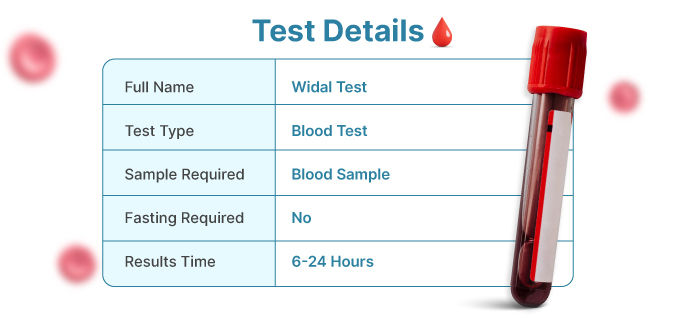 Widal Test Details