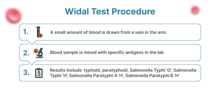 Widal Test Procedure