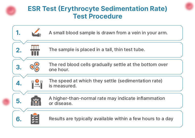 Procedure for Erythrocyte Sedimentation Rate Blood Test