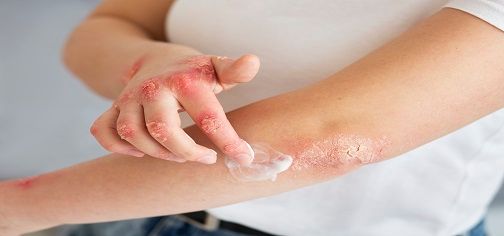 skin-rashes-causes-symptoms-treatment