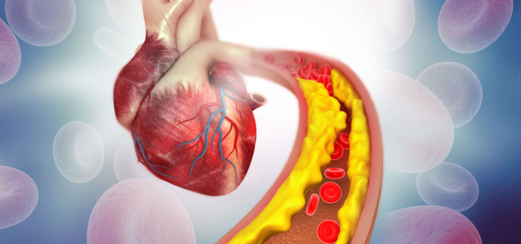 10 Effective Tips To Reduce Cholesterol