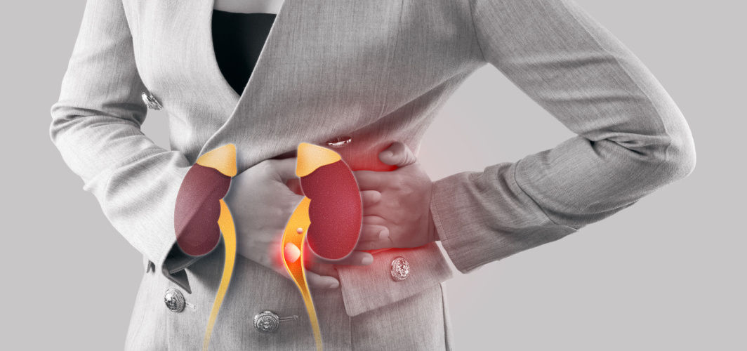 how-to-know-if-you-have-kidney-stones