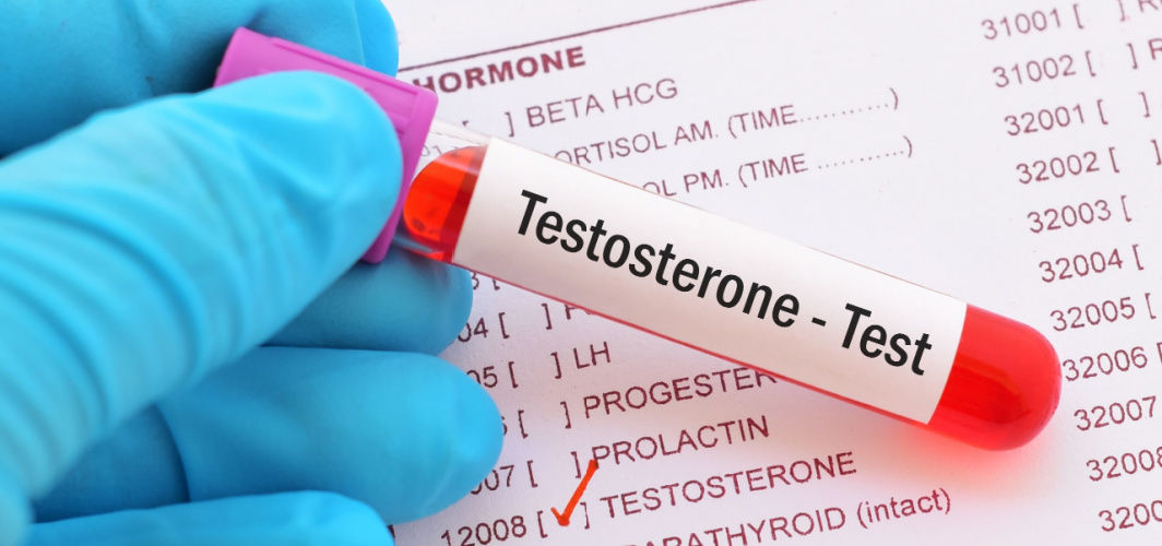 A Comprehensive Guide on how to test testosterone levels