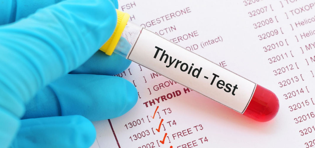 Thyroid Tests: Process, Preparations, And Results