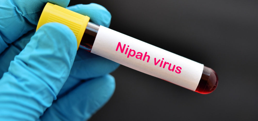 Nipah Virus: What Is It, Symptoms, Cause, Prevention, Treatment