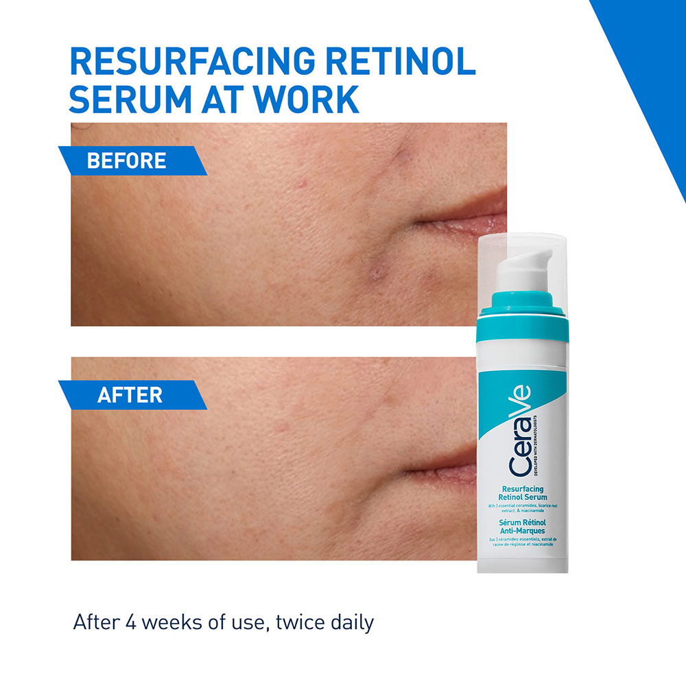 CeraVe Resurfacing Retinol Serum 30 ml | Reduces Acne Marks with Licorice Root Extract & Niacinamide, Pack of 1 CeraVe Resurfacing Retinol Serum 30 ml | Reduces Acne Marks with Licorice Root Extract & Niacinamide, Pack of 1