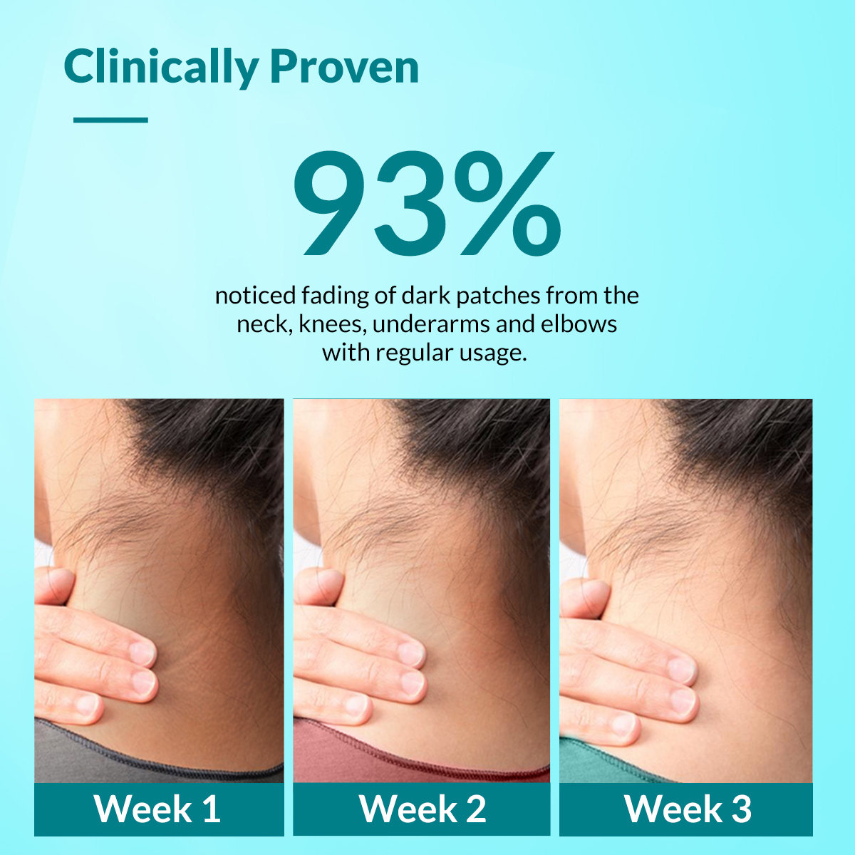 Fixderma Nigrifix Cream, 100 gm, Pack of 1 Fixderma Nigrifix Cream, 100 gm, Pack of 1