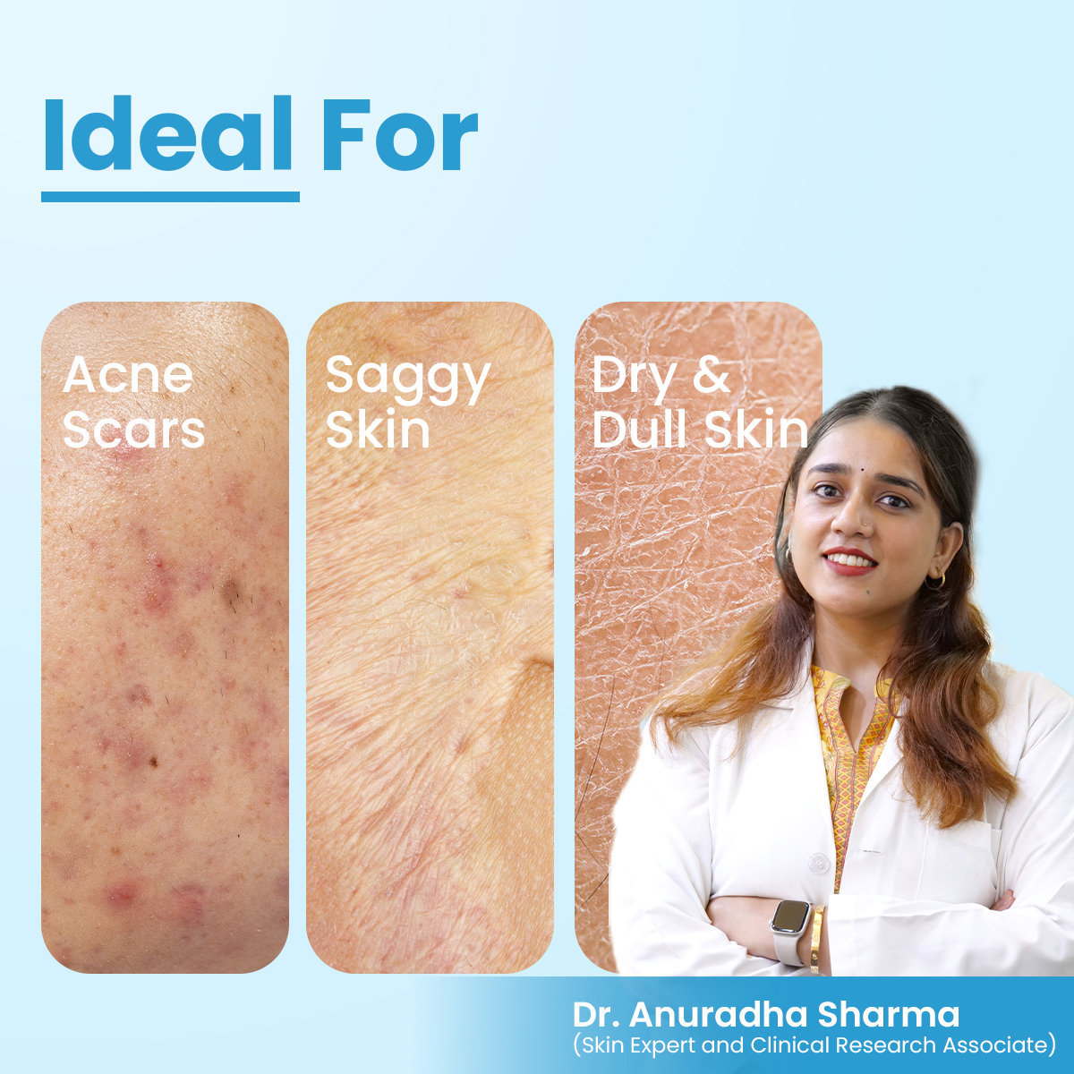 Fixderma Cosmetic Laboratories (FCL) Bio Retinol Body Lotion, 200 ml, Pack of 1 Fixderma Cosmetic Laboratories (FCL) Bio Retinol Body Lotion, 200 ml, Pack of 1