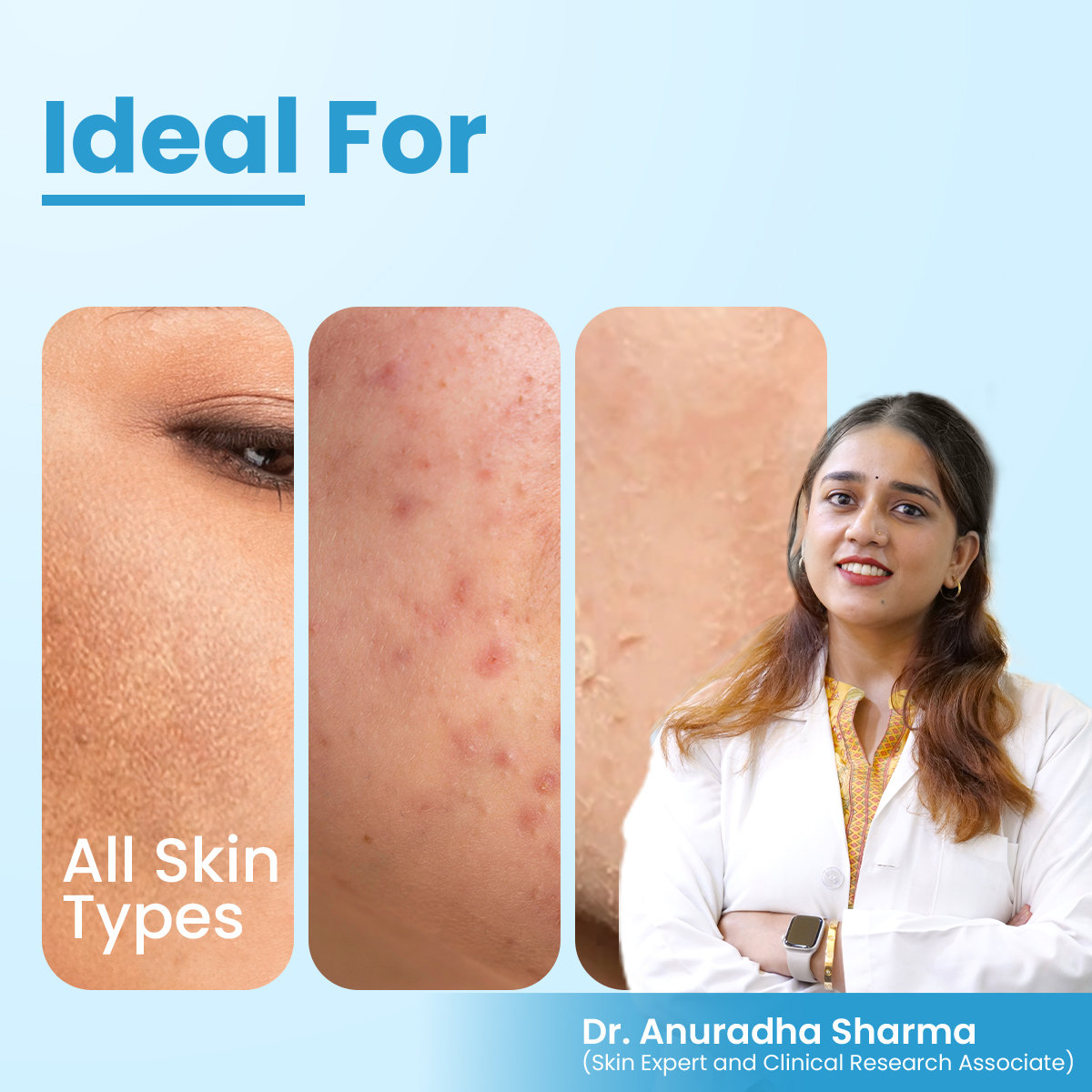 Fixderma Aha Lightening Gel, 30 ml, Pack of 1 Fixderma Aha Lightening Gel, 30 ml, Pack of 1