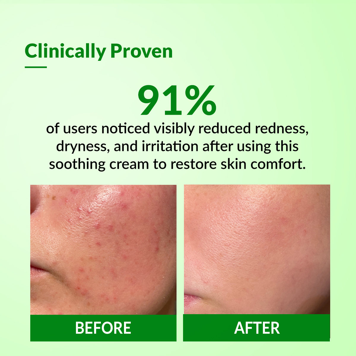 Fixderma Cleovera Cream, 60 gm, Pack of 1 Fixderma Cleovera Cream, 60 gm, Pack of 1