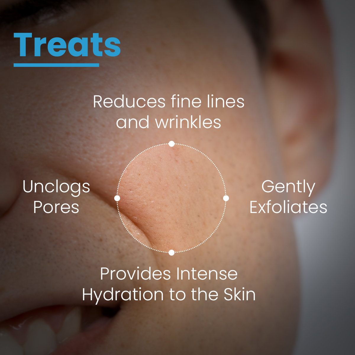 Fixderma Penta Peel Pads, 25 count, Pack of 1 Fixderma Penta Peel Pads, 25 count, Pack of 1