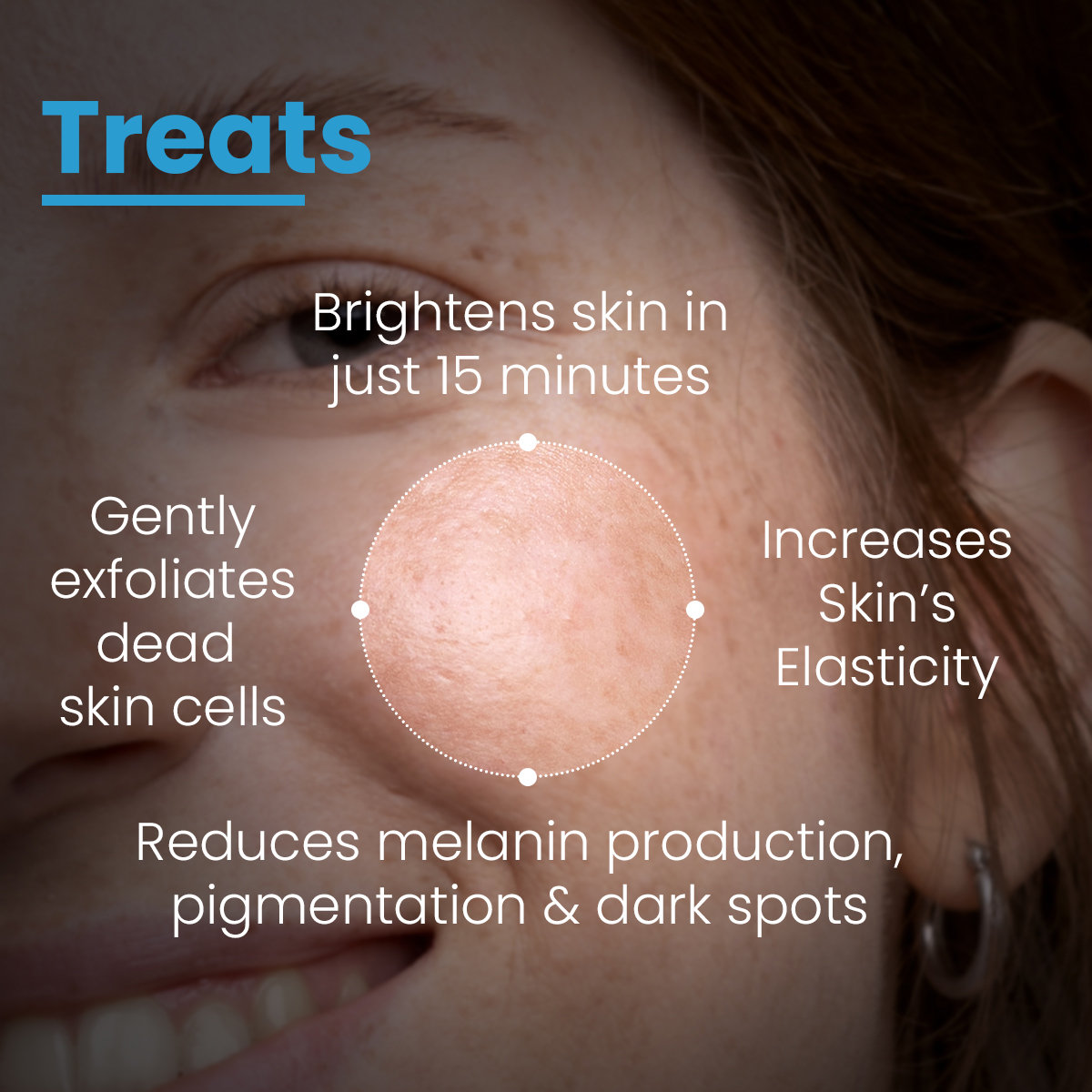 Fixderma PBA Face Mask, 100 gm, Pack of 1 Fixderma PBA Face Mask, 100 gm, Pack of 1