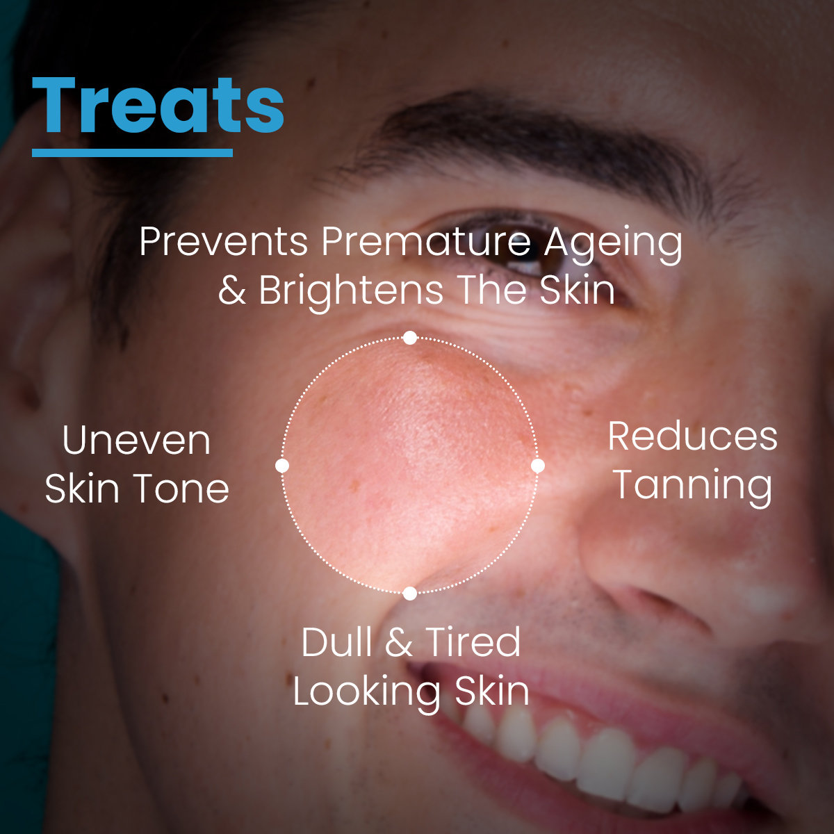 Fixderma Cosmetic Laboratories (FCL) Active Radiance Complex For Men Serum, 50 gm, Pack of 1 Fixderma Cosmetic Laboratories (FCL) Active Radiance Complex For Men Serum, 50 gm, Pack of 1