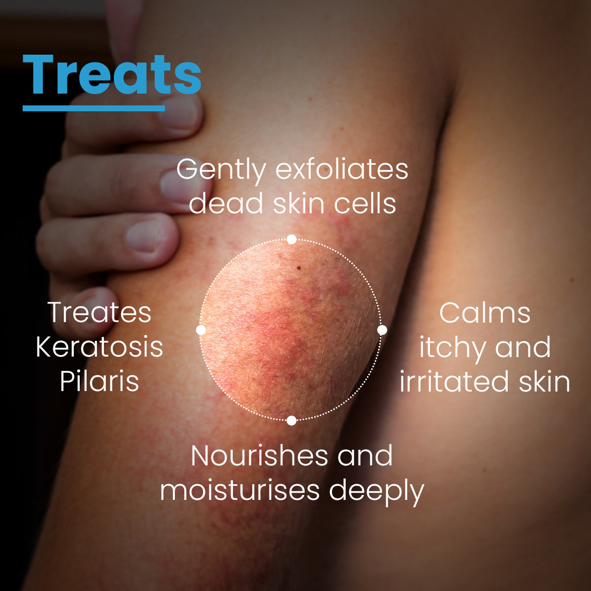 Fixderma Cosmetic Laboratories (FCL) AHA 20% Lotion, 100 ml, Pack of 1 Fixderma Cosmetic Laboratories (FCL) AHA 20% Lotion, 100 ml, Pack of 1