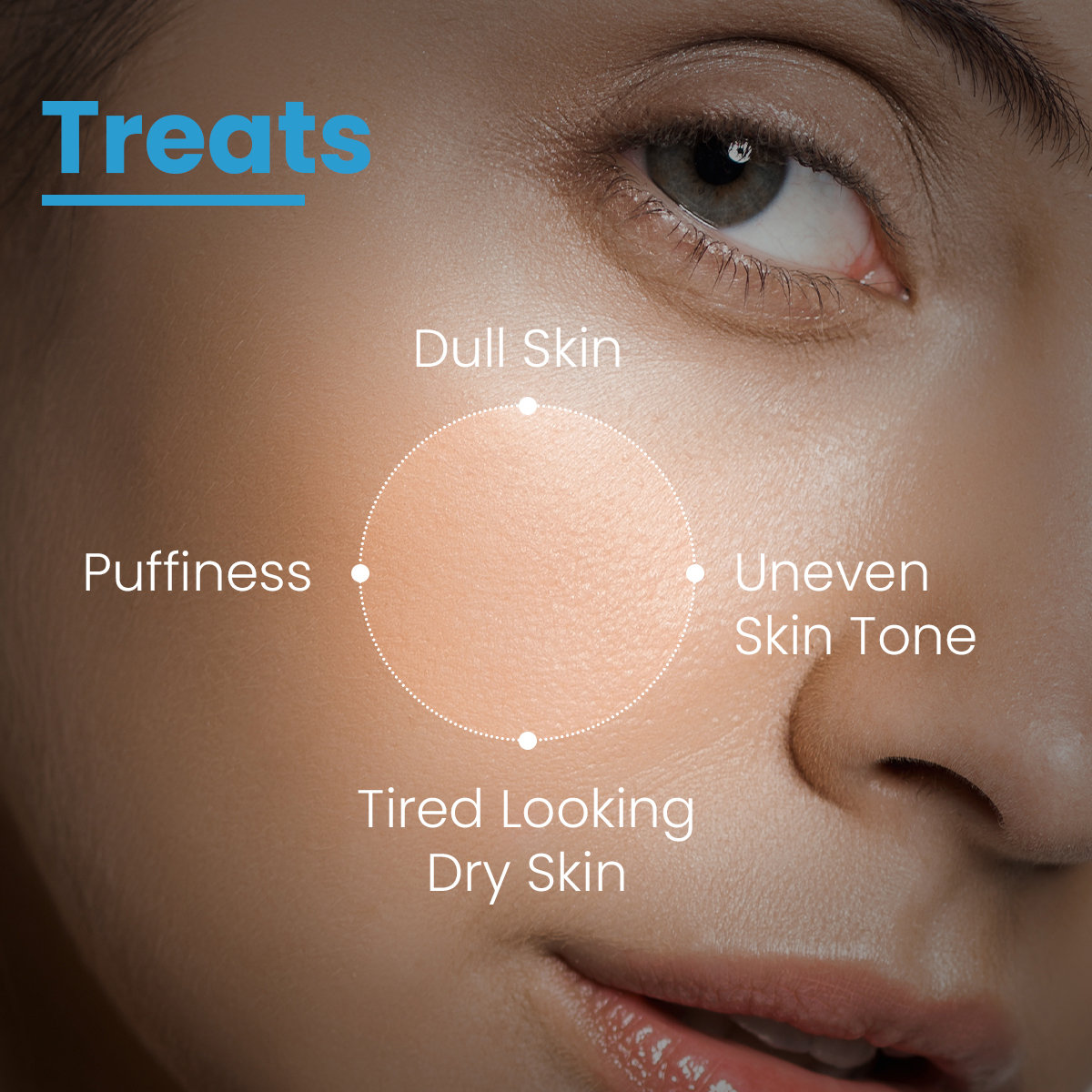 Fixderma Cosmetic Laboratories (FCL) Skin Brightening Complex Serum, 30 gm, Pack of 1 Fixderma Cosmetic Laboratories (FCL) Skin Brightening Complex Serum, 30 gm, Pack of 1