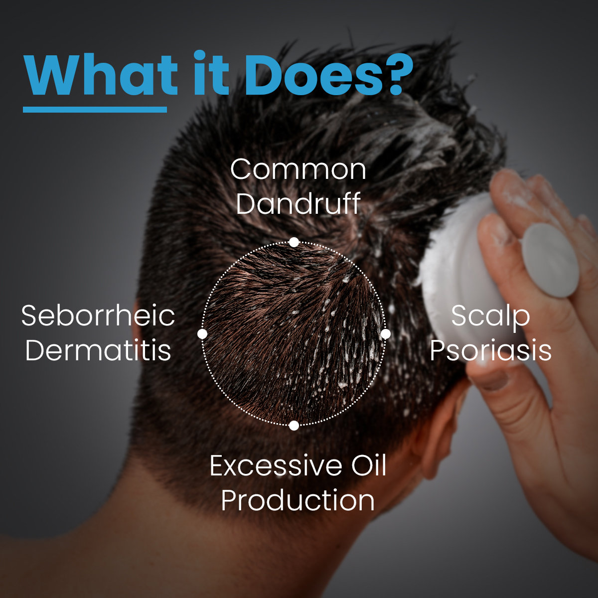 Fixderma Cosmetic Laboratories (FCL) T-Anti Dandruff Shampoo, 200 ml, Pack of 1 Fixderma Cosmetic Laboratories (FCL) T-Anti Dandruff Shampoo, 200 ml, Pack of 1